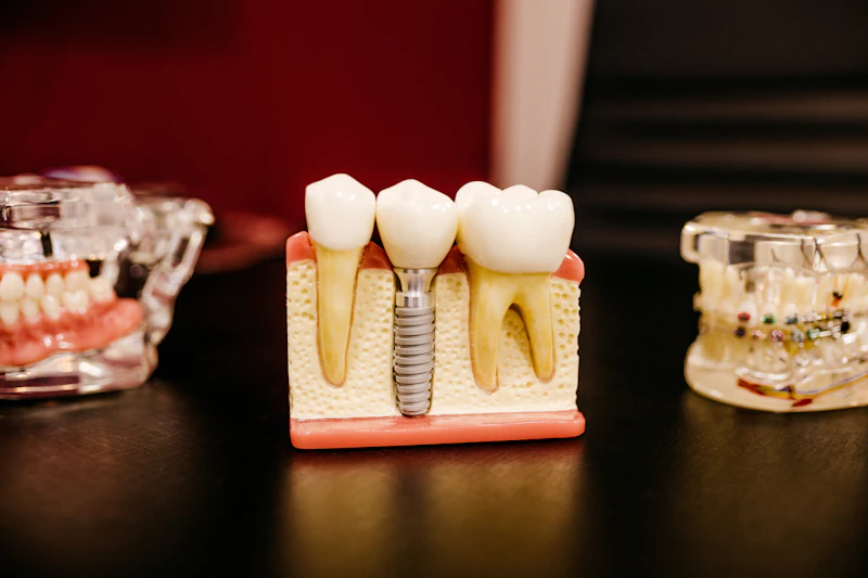 A model showing a replacement tooth fixed on a metal post in the jaw
